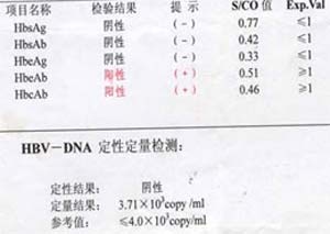 DNA定量怎么看